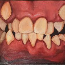 Painting of a set of human teeth with extra canines coming through the gums above the regular set